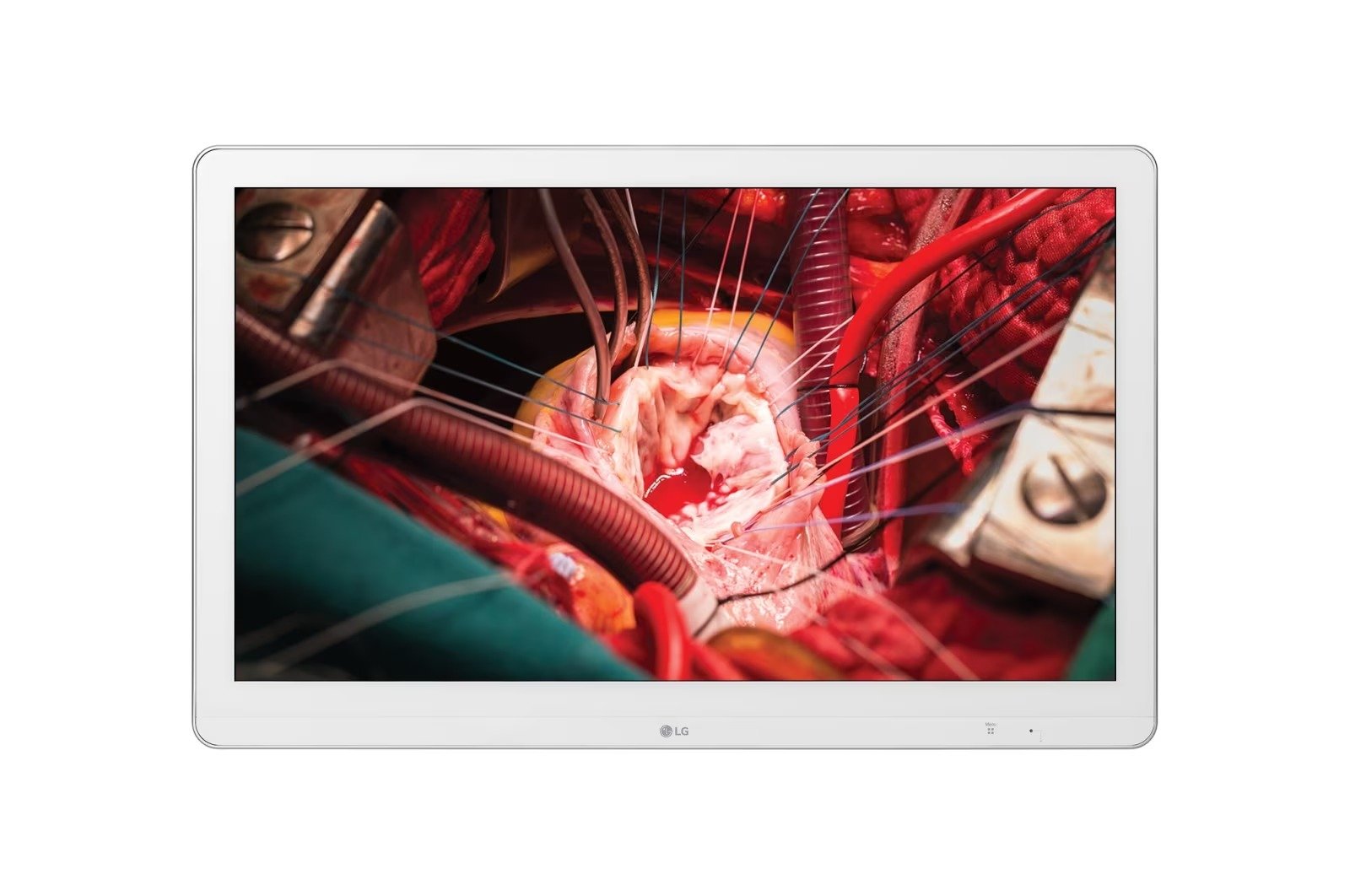 Medical Grade Monitor
