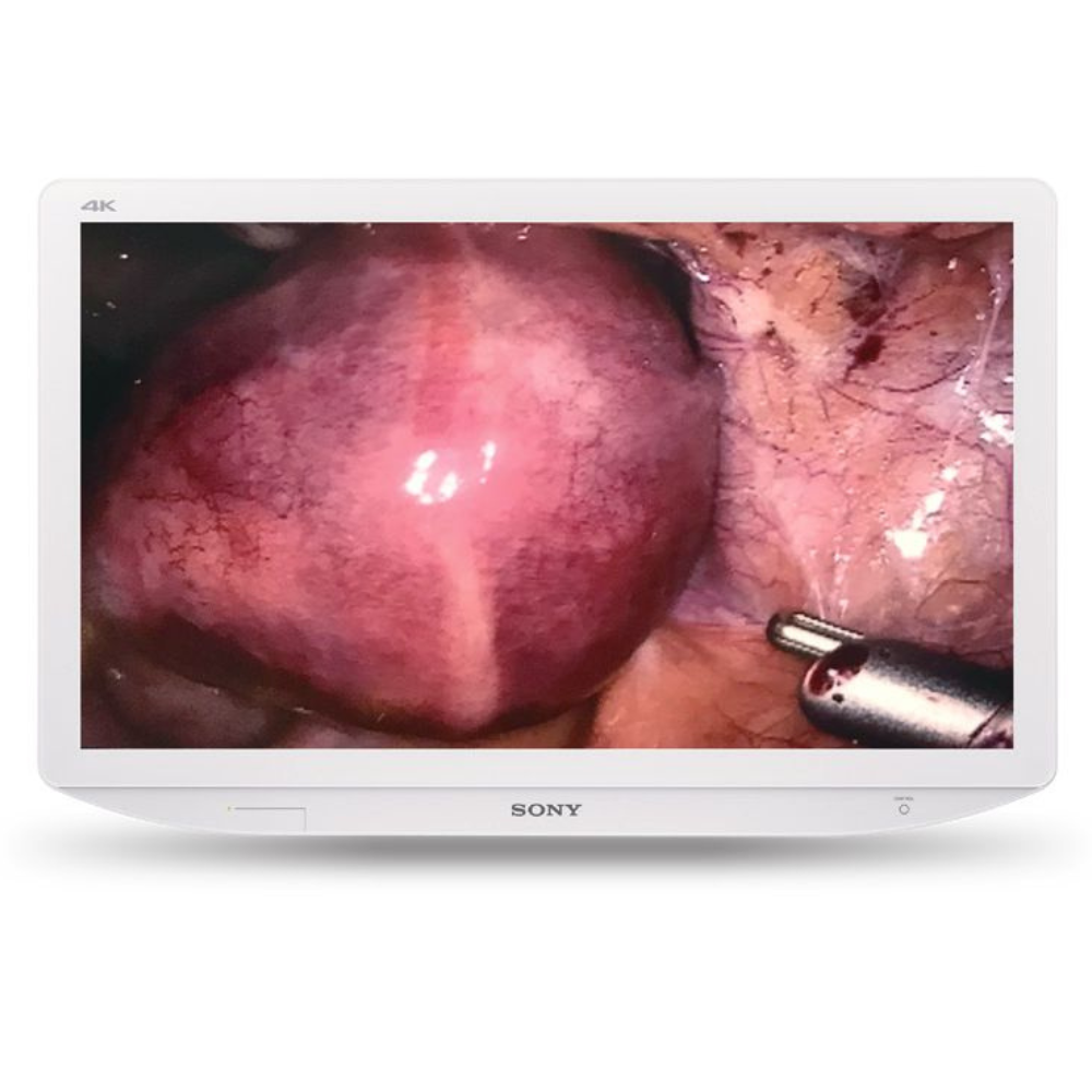 Sonly 4k medical grade monitor (5)